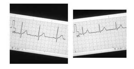 Method for digitalizing paper electrocardiogram