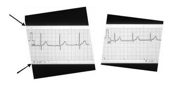 Method for digitalizing paper electrocardiogram