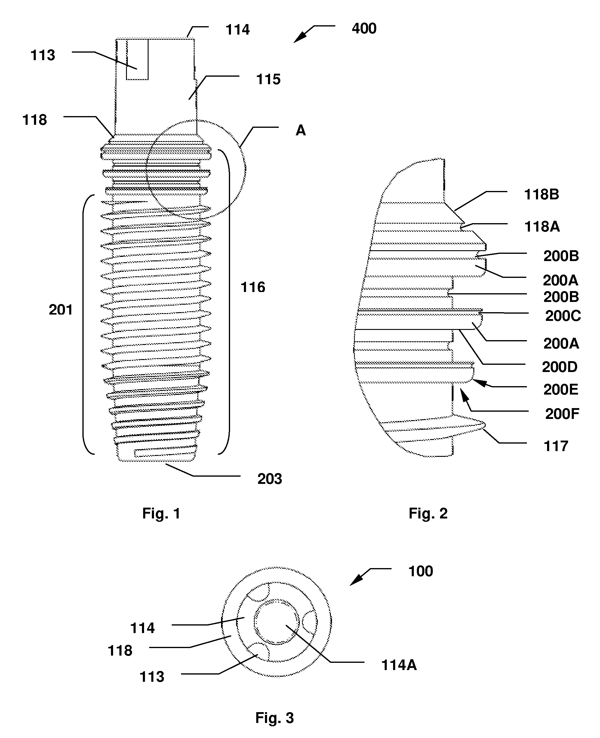 Dental Implant System and Method