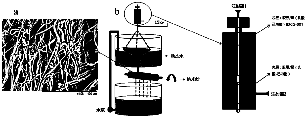 A biodegradable nano yarn inhibiting fibrosis and its preparation and application