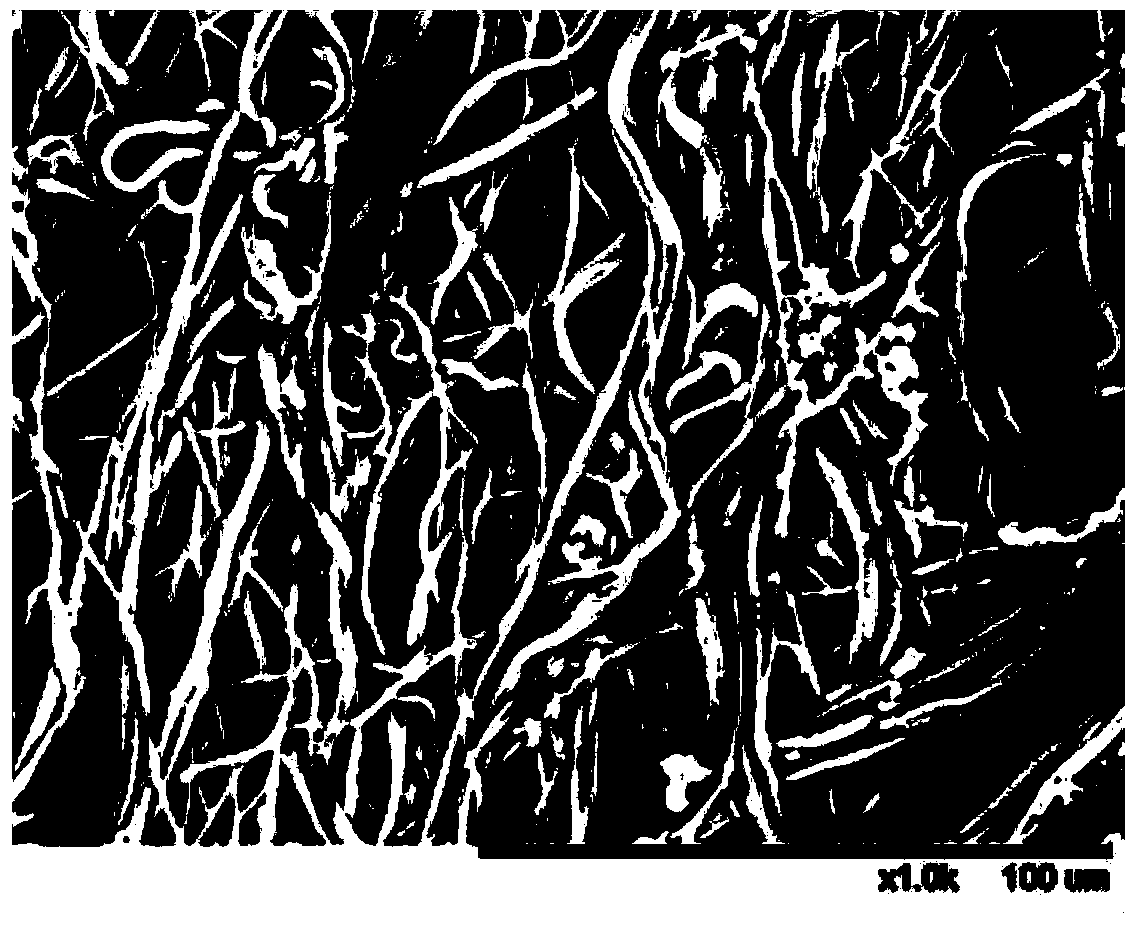 A biodegradable nano yarn inhibiting fibrosis and its preparation and application