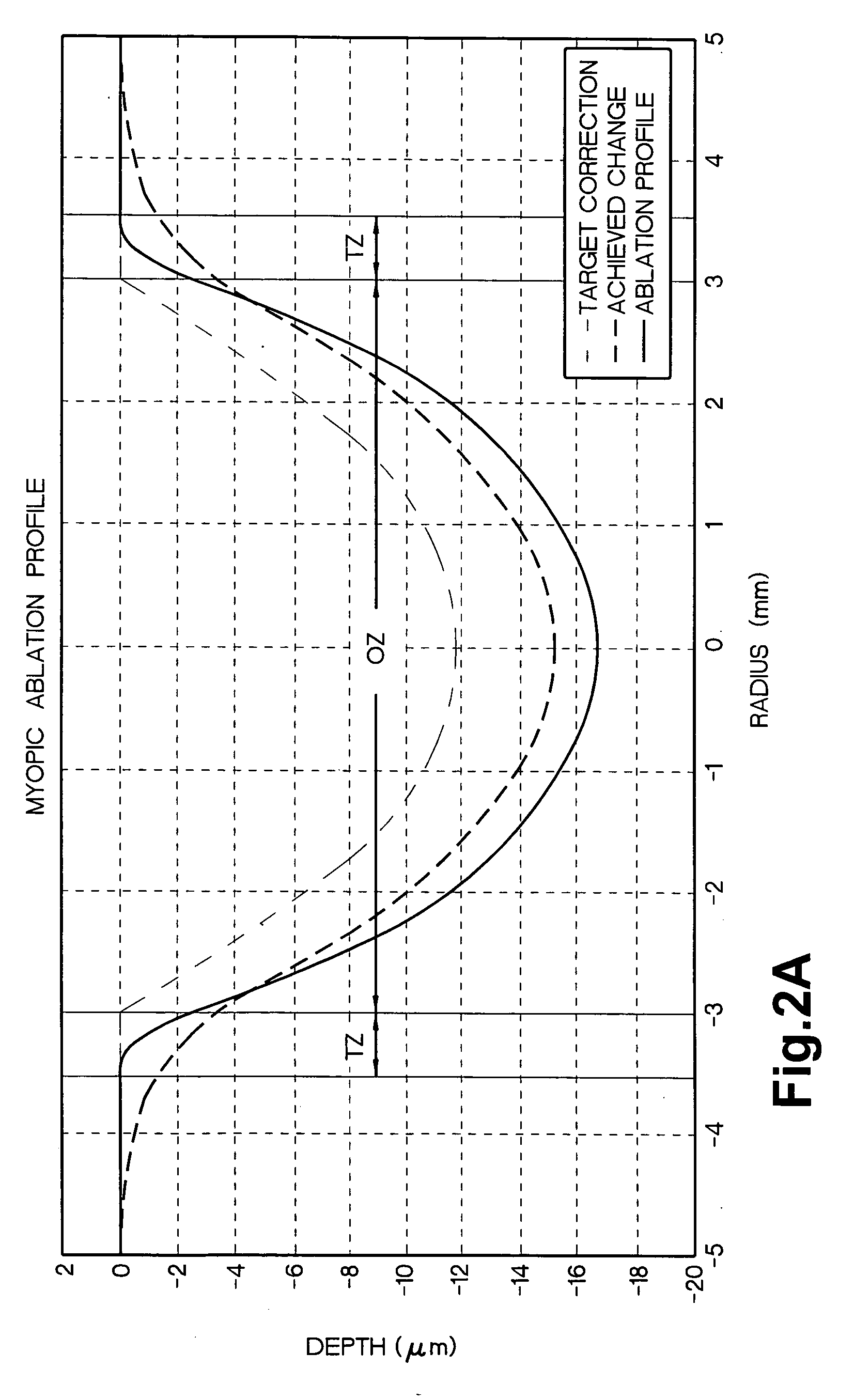 Method and apparatus for controlling ablation in refractive surgery