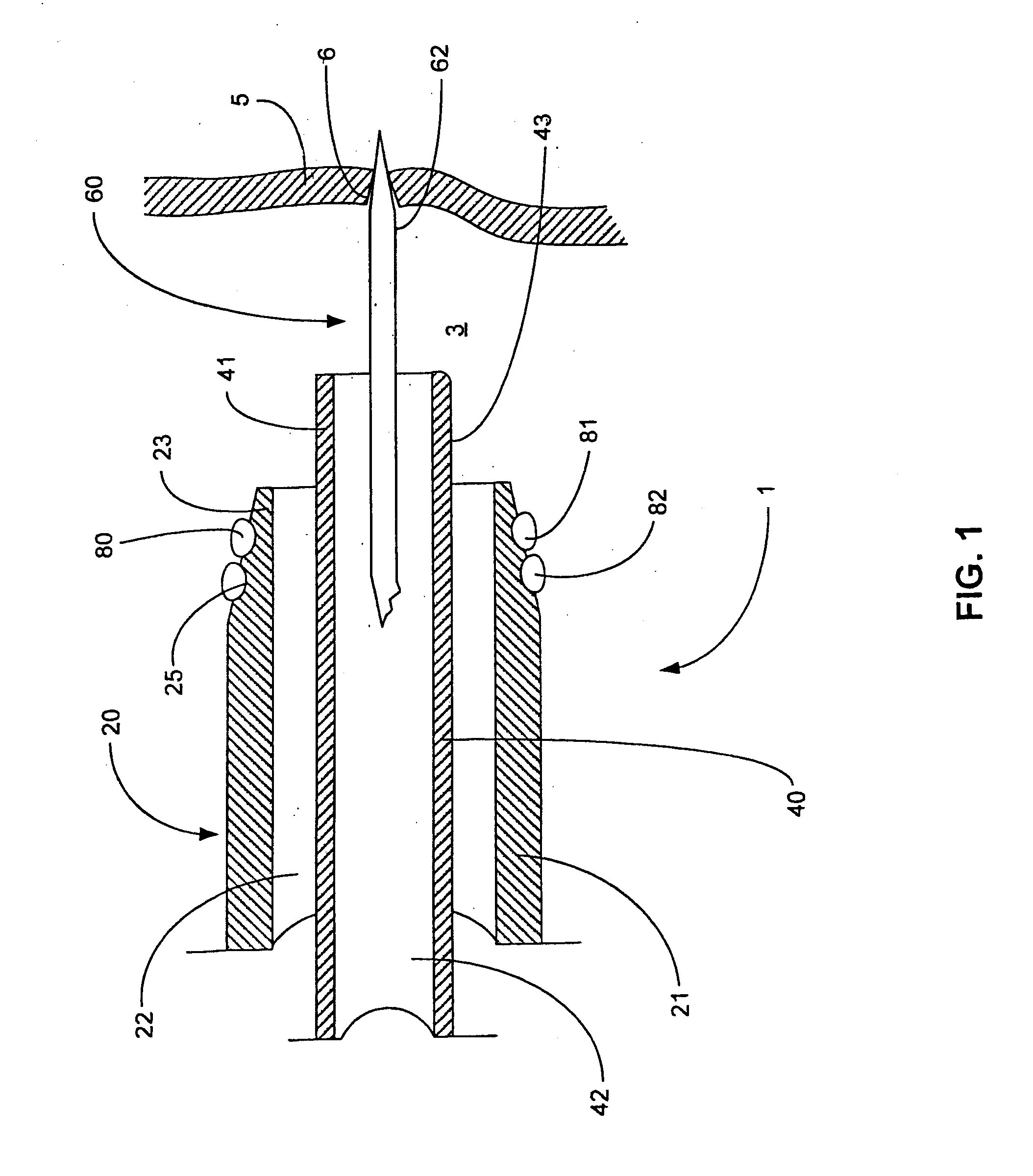 Tissue securing and sealing apparatus and related methods of use