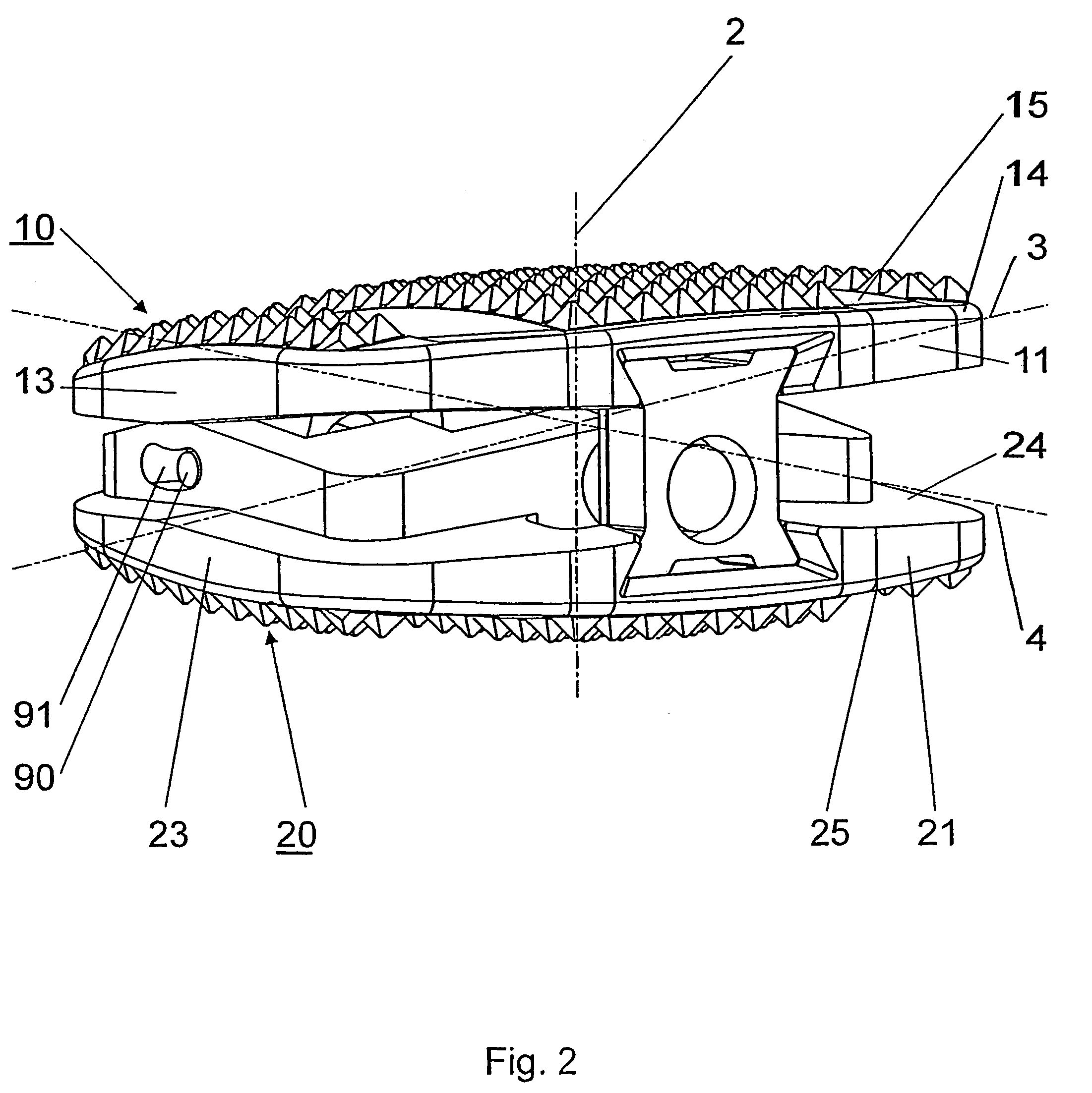 Intervertebral implant with joint parts mounted on roller bodies