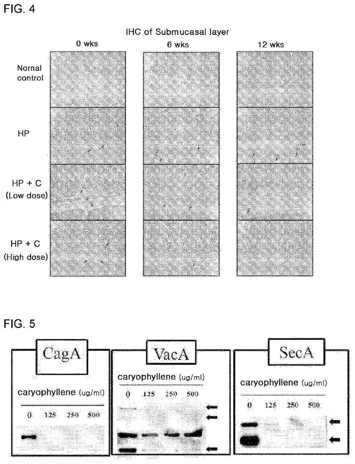 Anti-helicobacter food composition comprising beta-caryophyllene