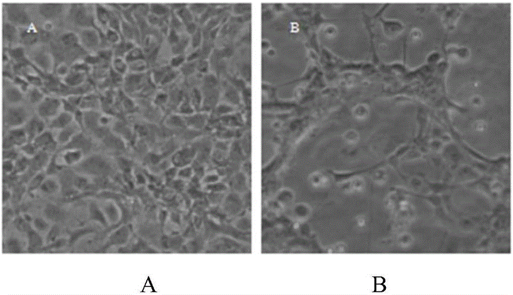 Salmons IHNV monoclonal antibody and detection kit