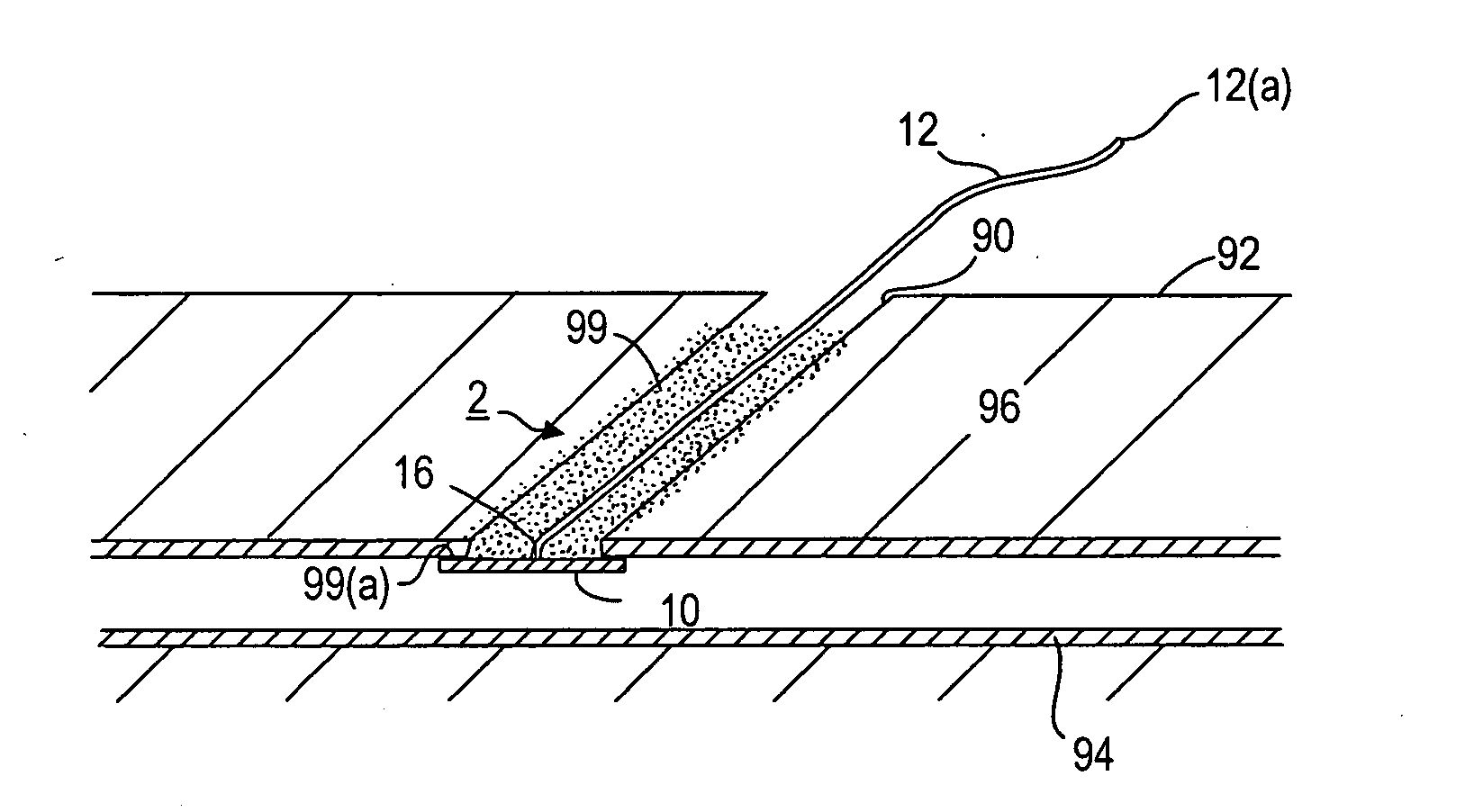 Apparatus and methods for facilitating hemostasis within a vascular puncture