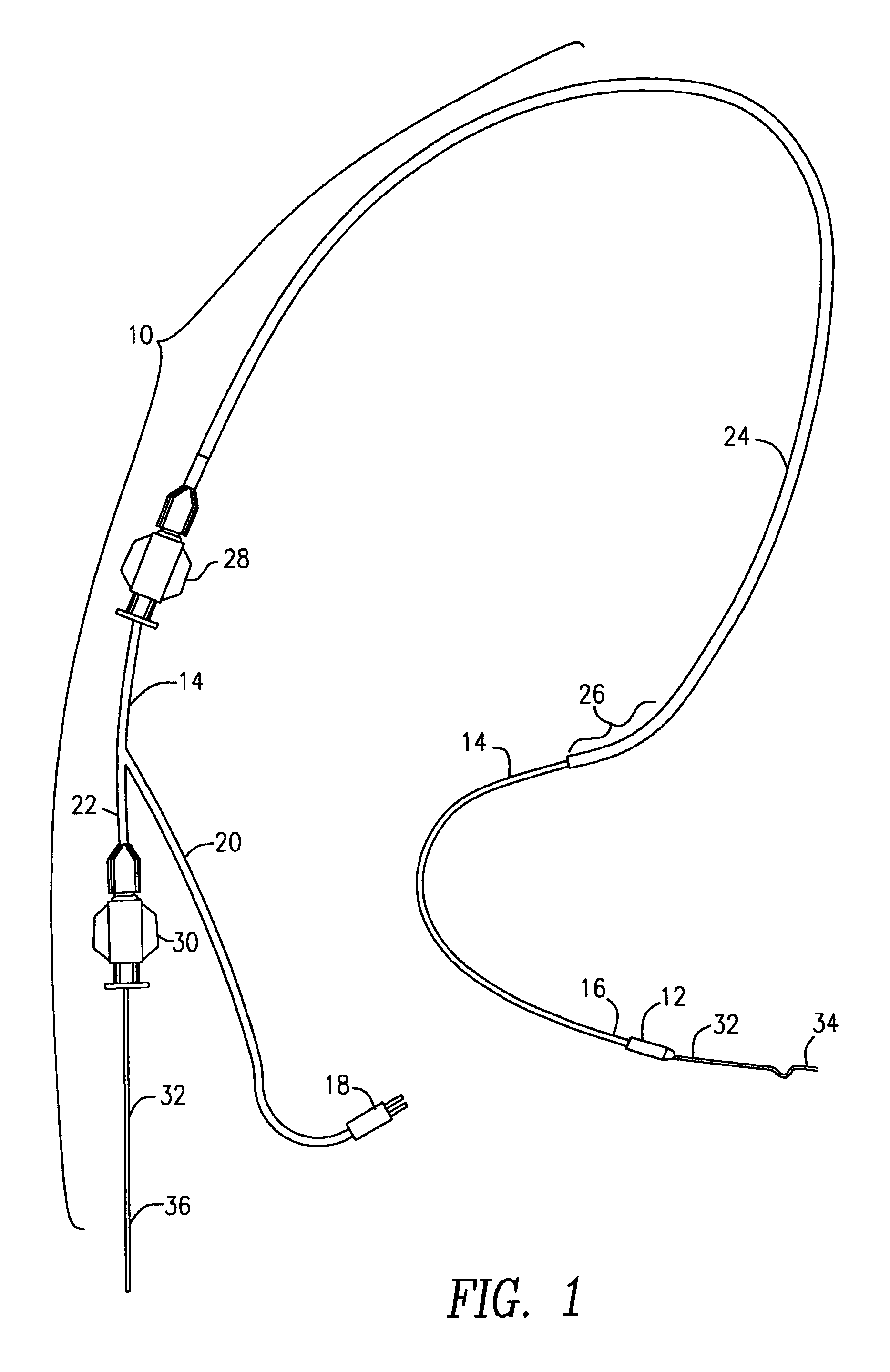 Apparatus and method for transcervical sterilization by application of ultrasound
