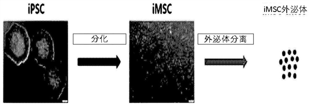 Composition for improving, preventing or treating skin diseases comprising induced pluripotent stem cell-derived mesenchymal stem cell and exosome derived therefrom