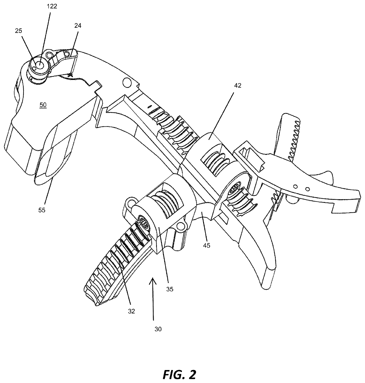 Bone align and joint preparation device and method