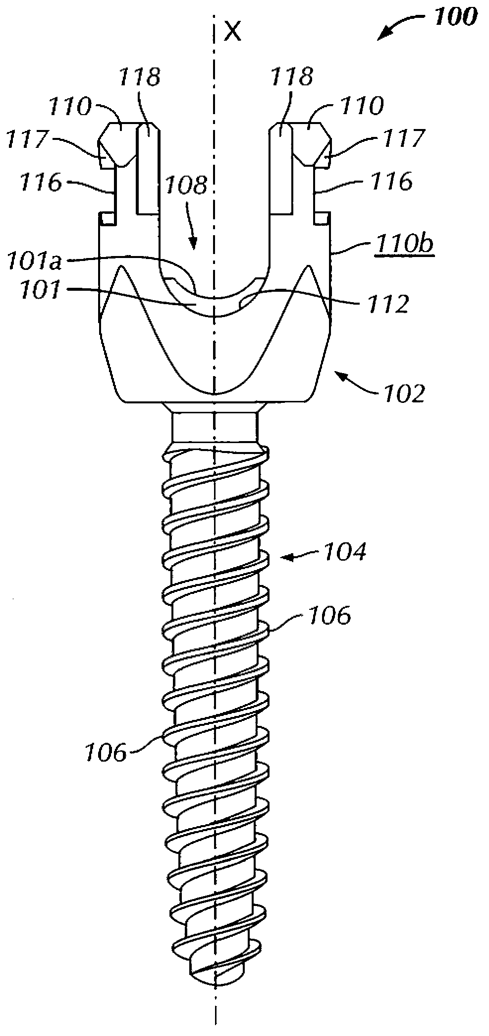 Spinal surgery instrument sets and methods