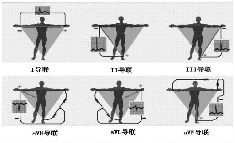 ST offset value calculation method and device, computer equipment and storage medium