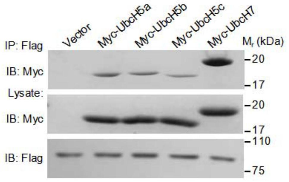 A target of anti-tuberculosis mycobacterium and its application