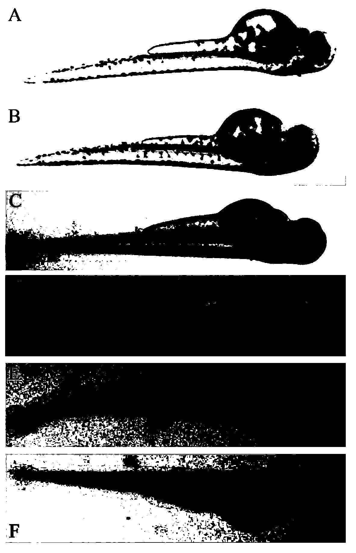 Application of terfenadine in preparation of zebra fish heart function damage model