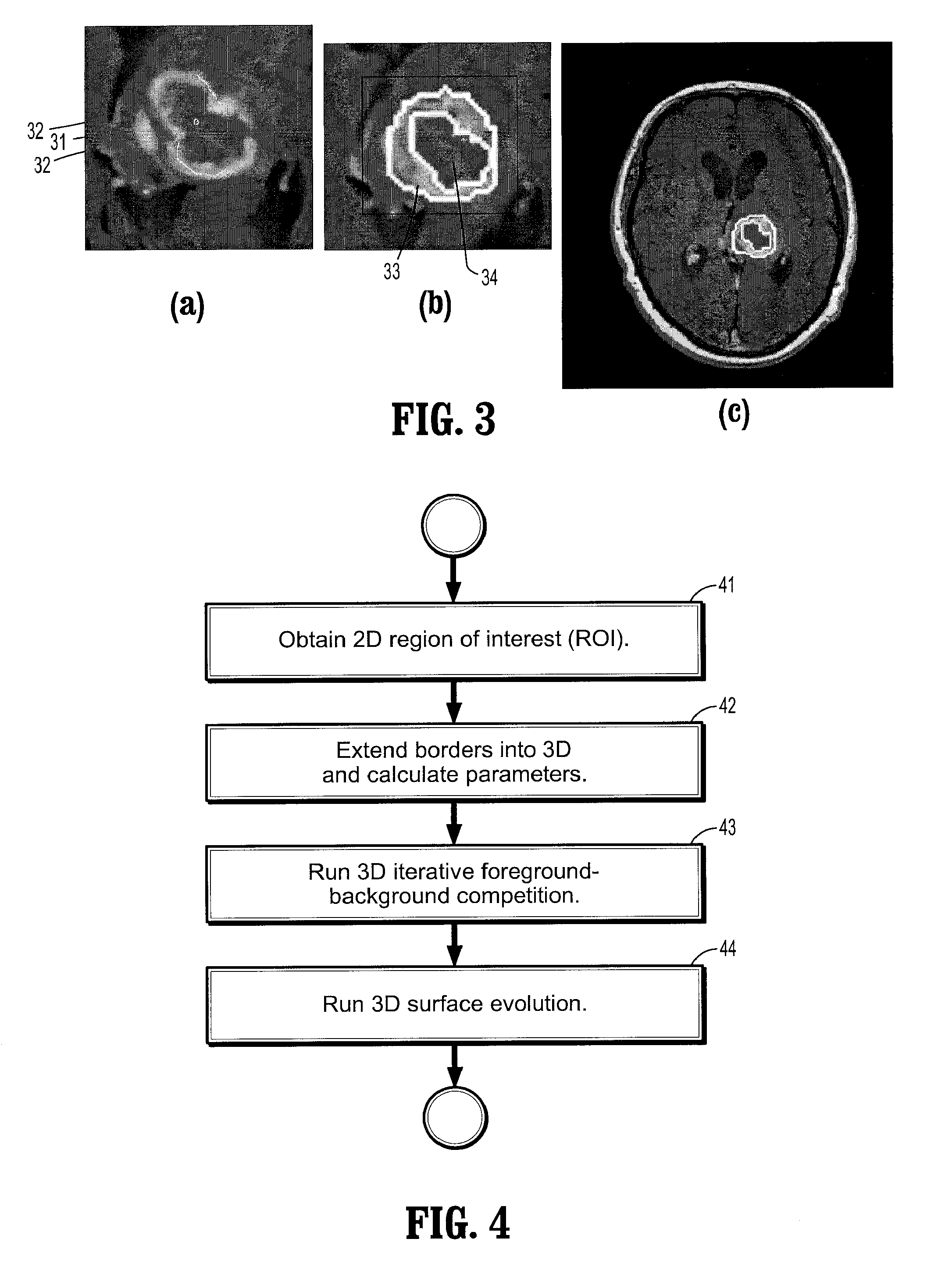 System and Method for Lesion Segmentation in Whole Body Magnetic Resonance Images
