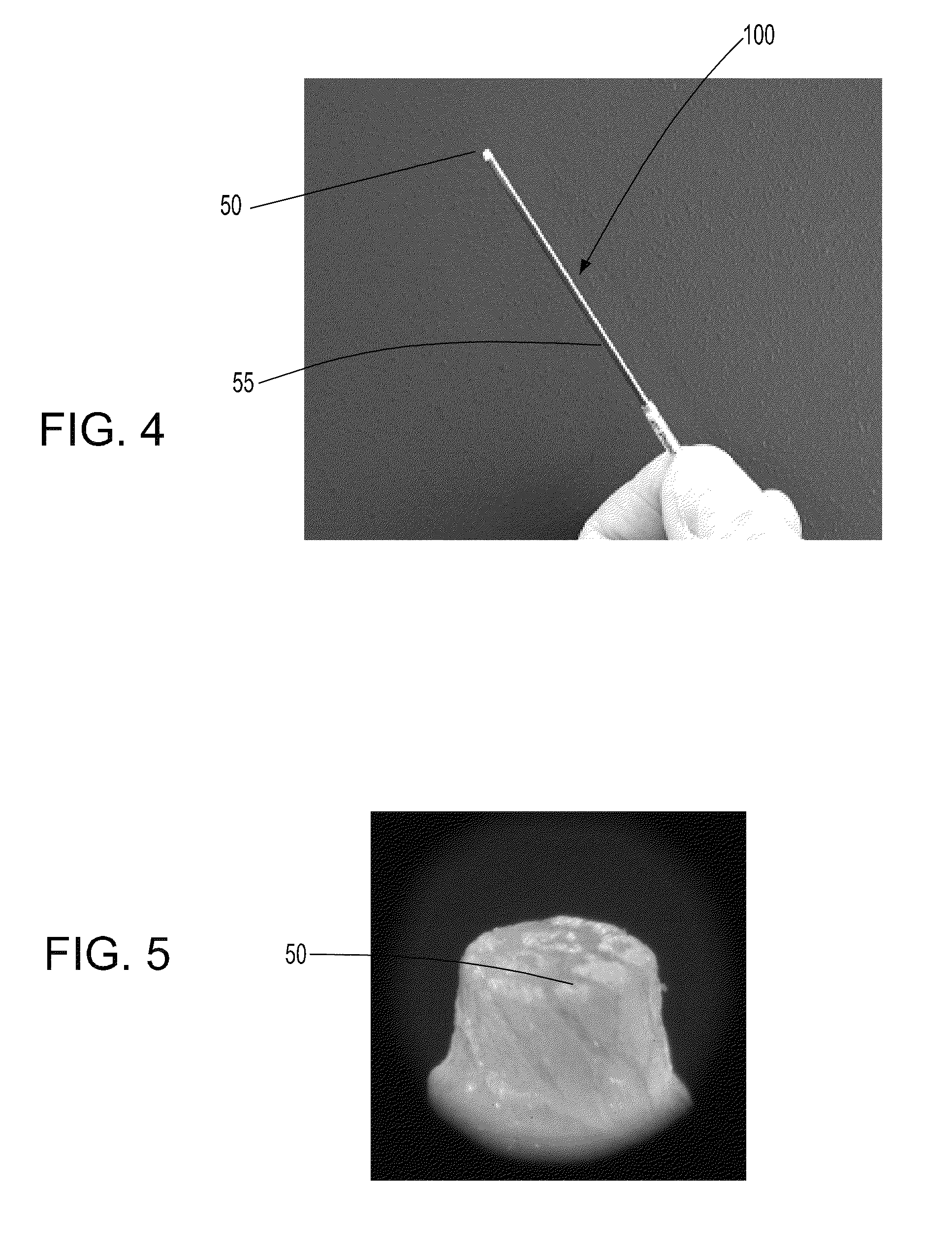 Microfabricated instruments and methods to treat recurrent corneal erosion