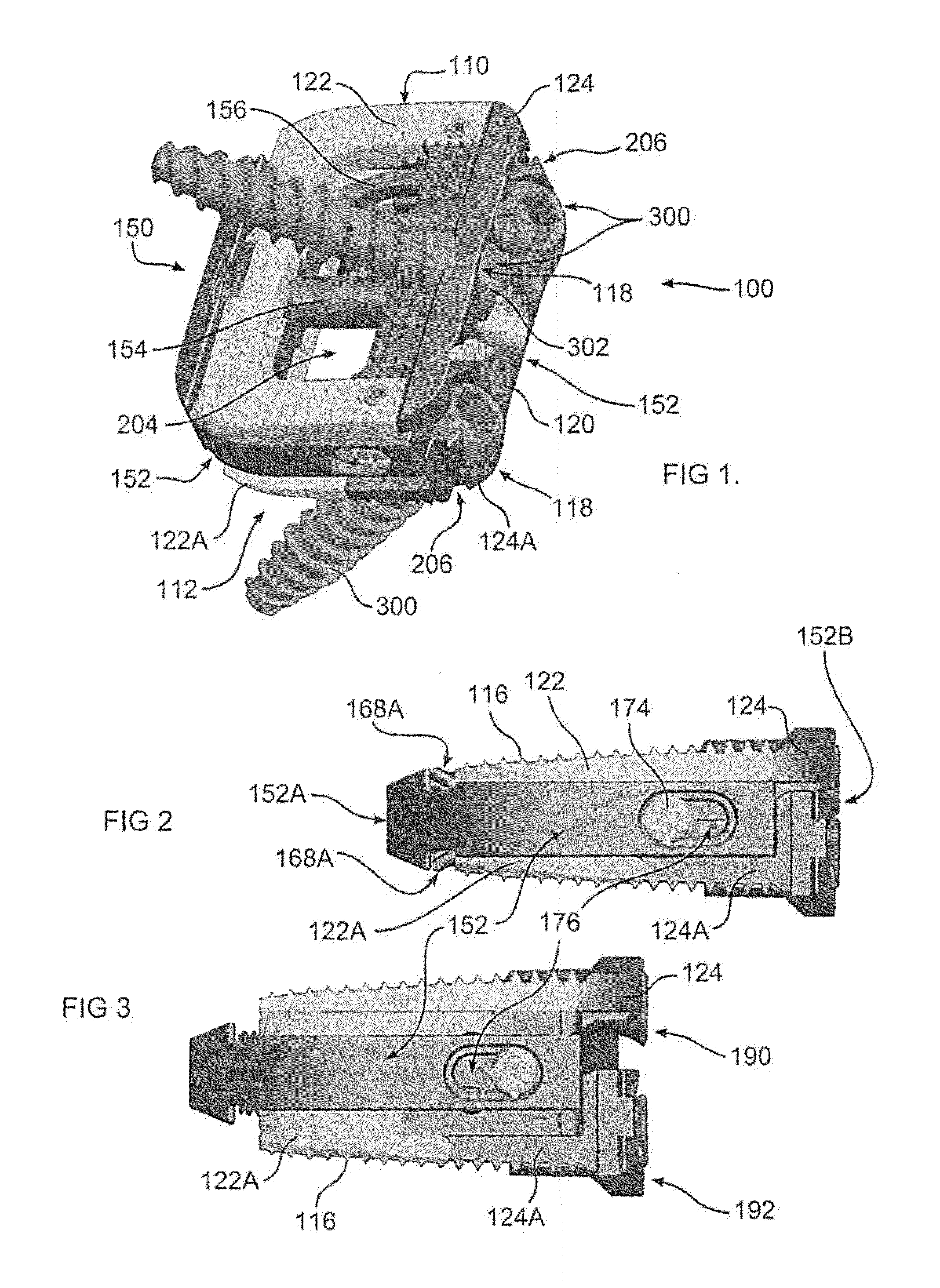 Expandable Intervertebral Implant