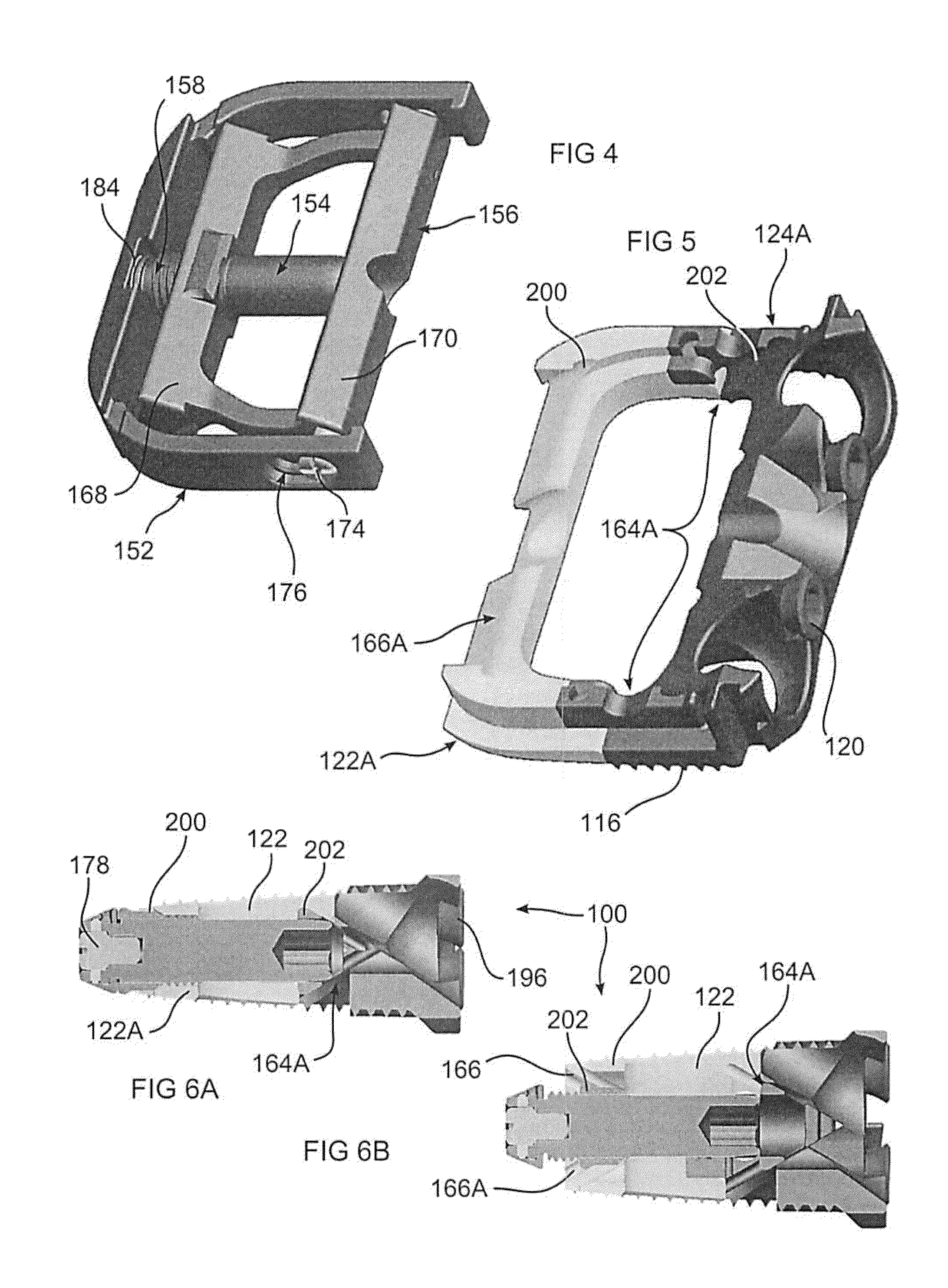 Expandable Intervertebral Implant