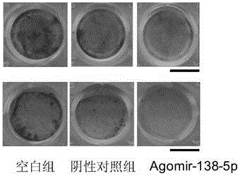 Application of oligonucleotide compound of micro-RNA (ribonucleic acid) associated with senile osteoporosis