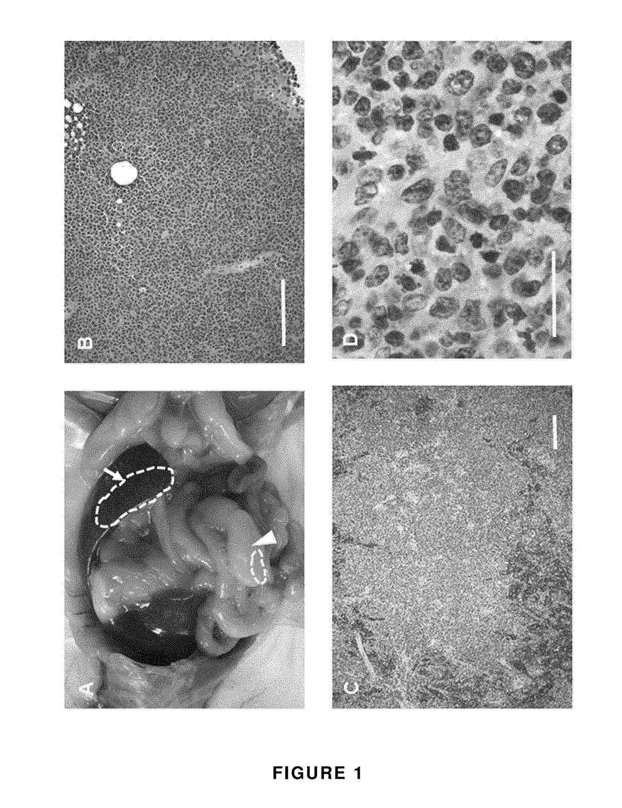 Mouse lymphoma cell line and animal model of human high grade b-cell lymphoma