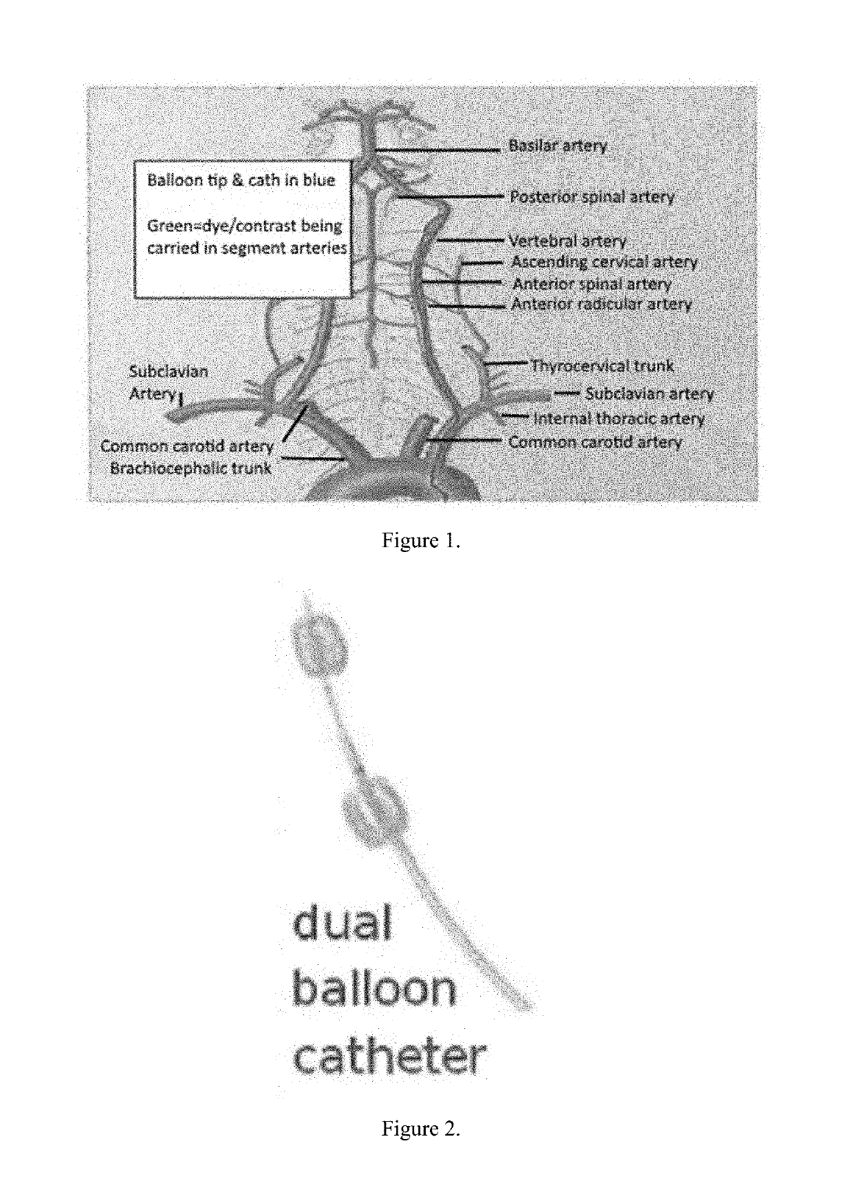 Non-invasive method for direct delivery of therapeutics to the spinal cord in the treatment of spinal cord pathology