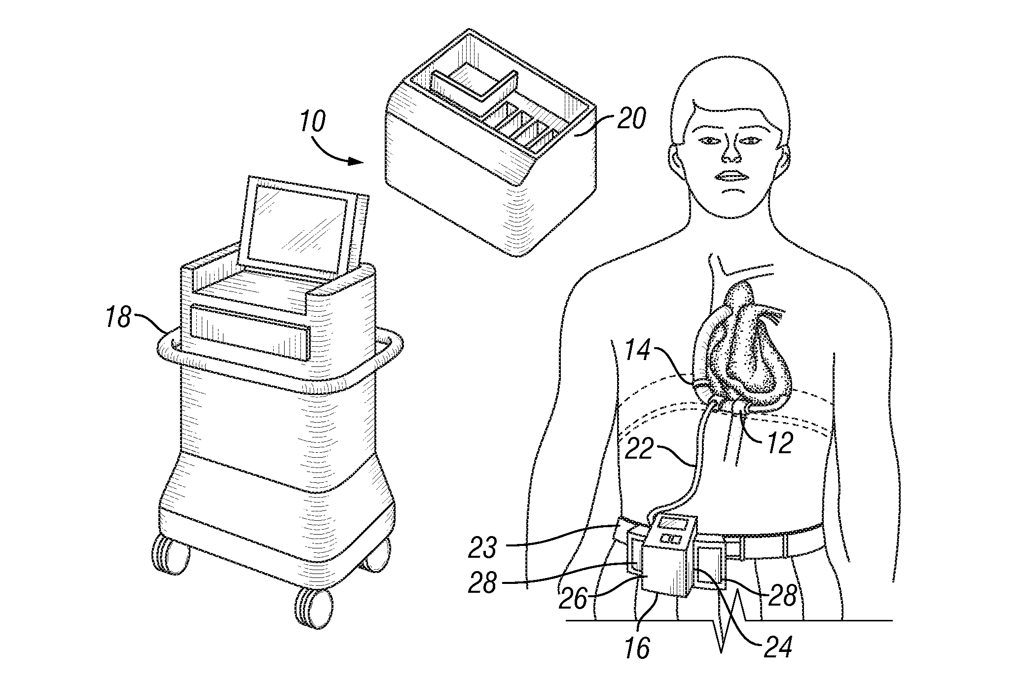 Blood pump system