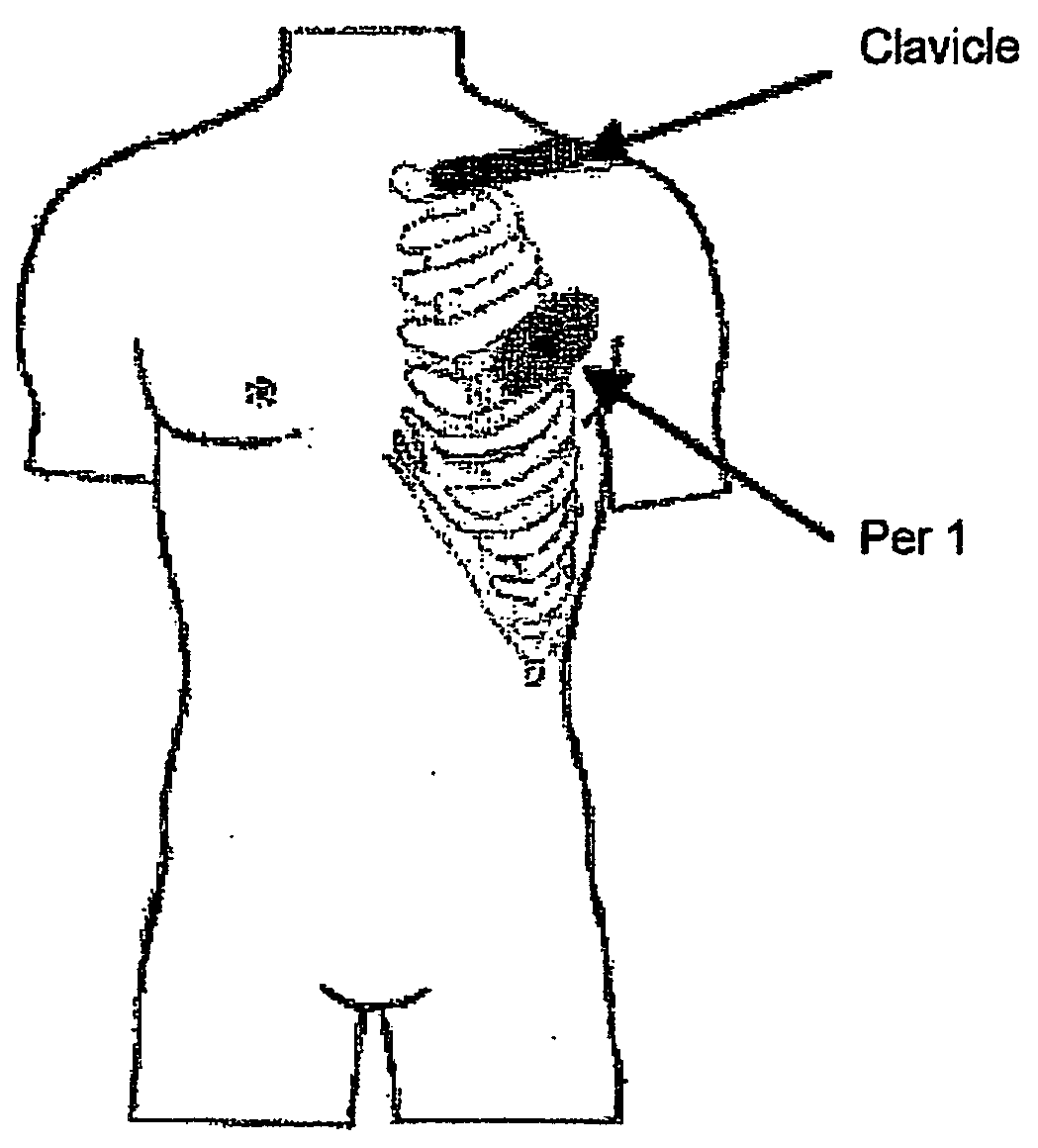 Evaluation of Sympathetic Tone