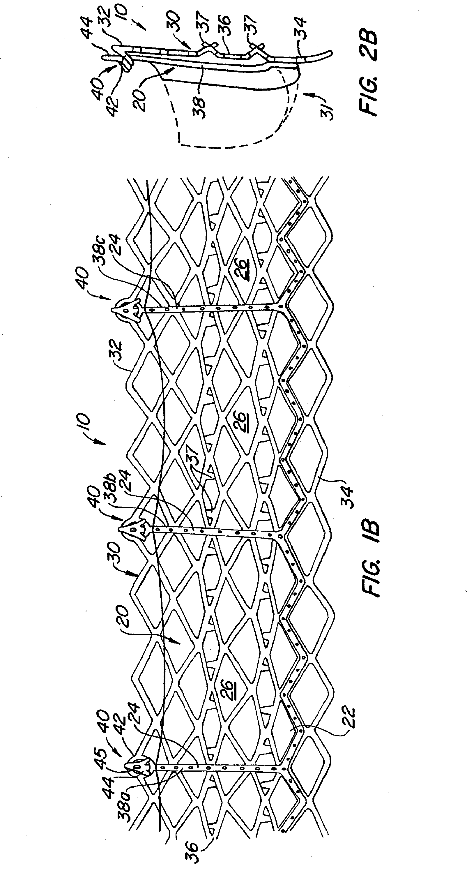 Externally Expandable Heart Valve Anchor and Method