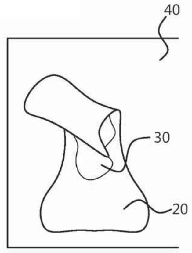 Method and system for characterizing stool patterns of young infants