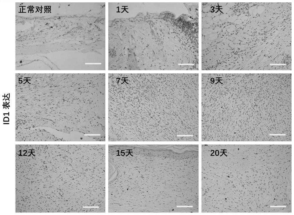 Application of ID1 and ID3 in reprogramming of fibroblasts into Schwann cells and promotion of peripheral nerve regeneration