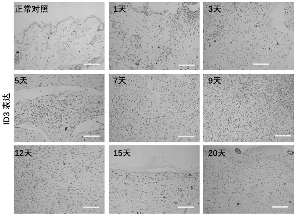 Application of ID1 and ID3 in reprogramming of fibroblasts into Schwann cells and promotion of peripheral nerve regeneration