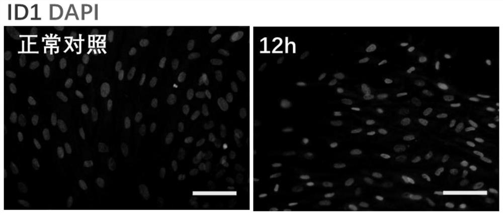 Application of ID1 and ID3 in reprogramming of fibroblasts into Schwann cells and promotion of peripheral nerve regeneration