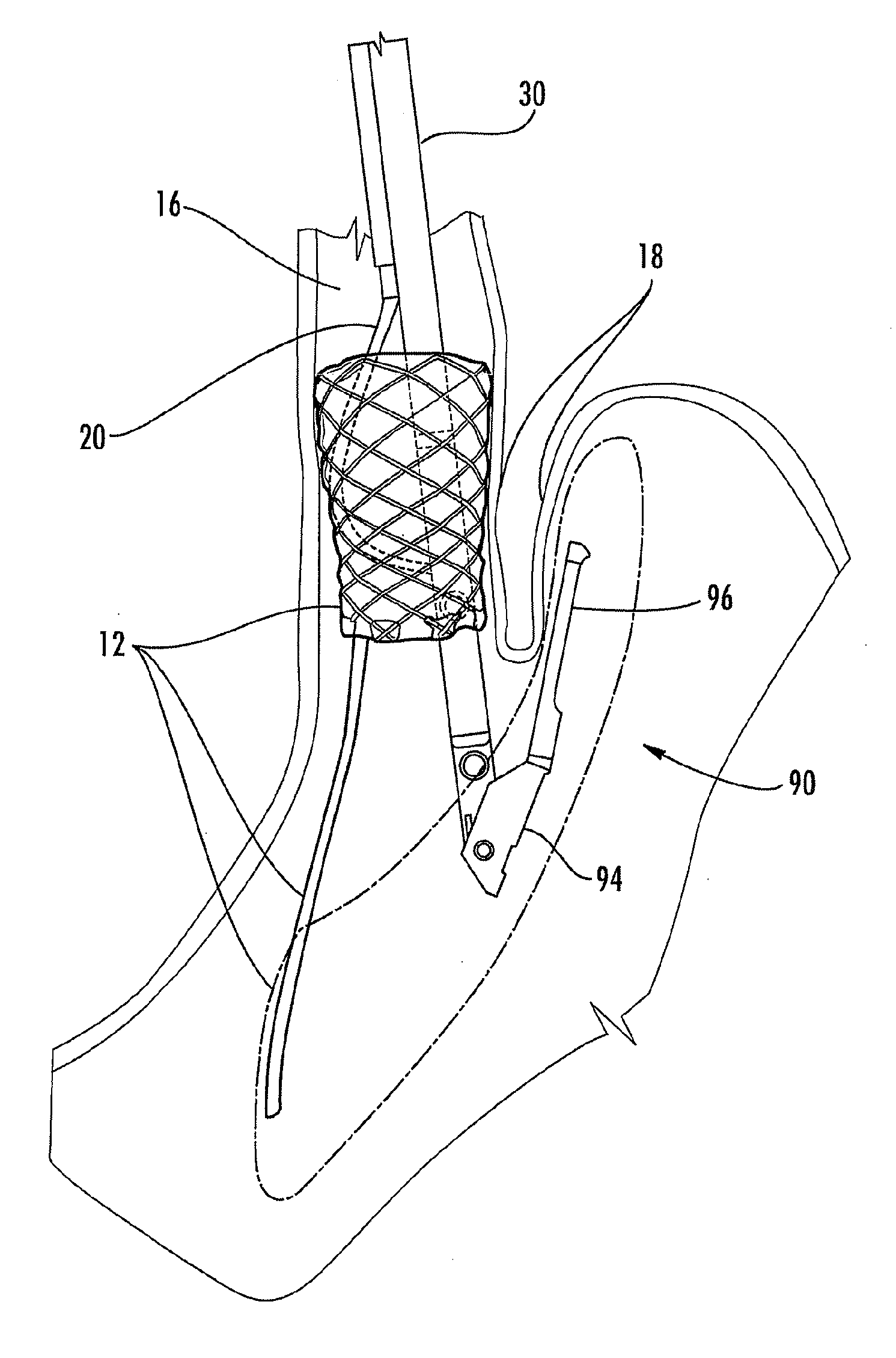 Medical device fixation tool and method of fixation of a medical device