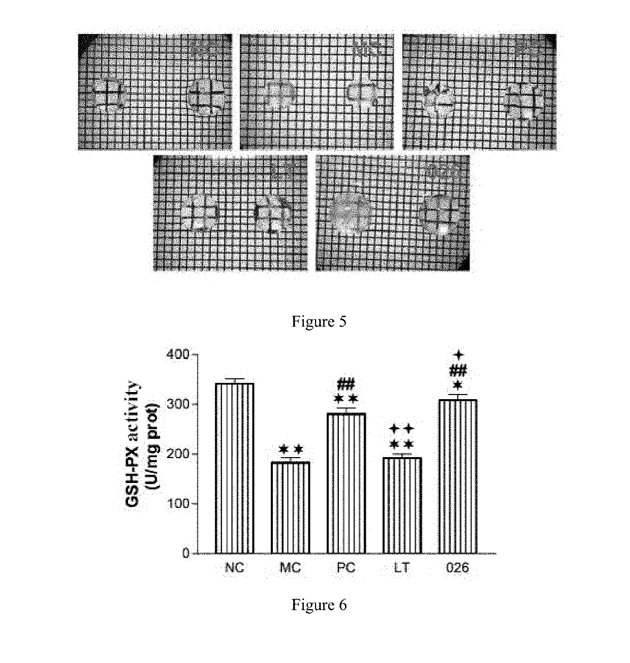 Lanosterol prodrug compound and preparation method therefor and use thereof