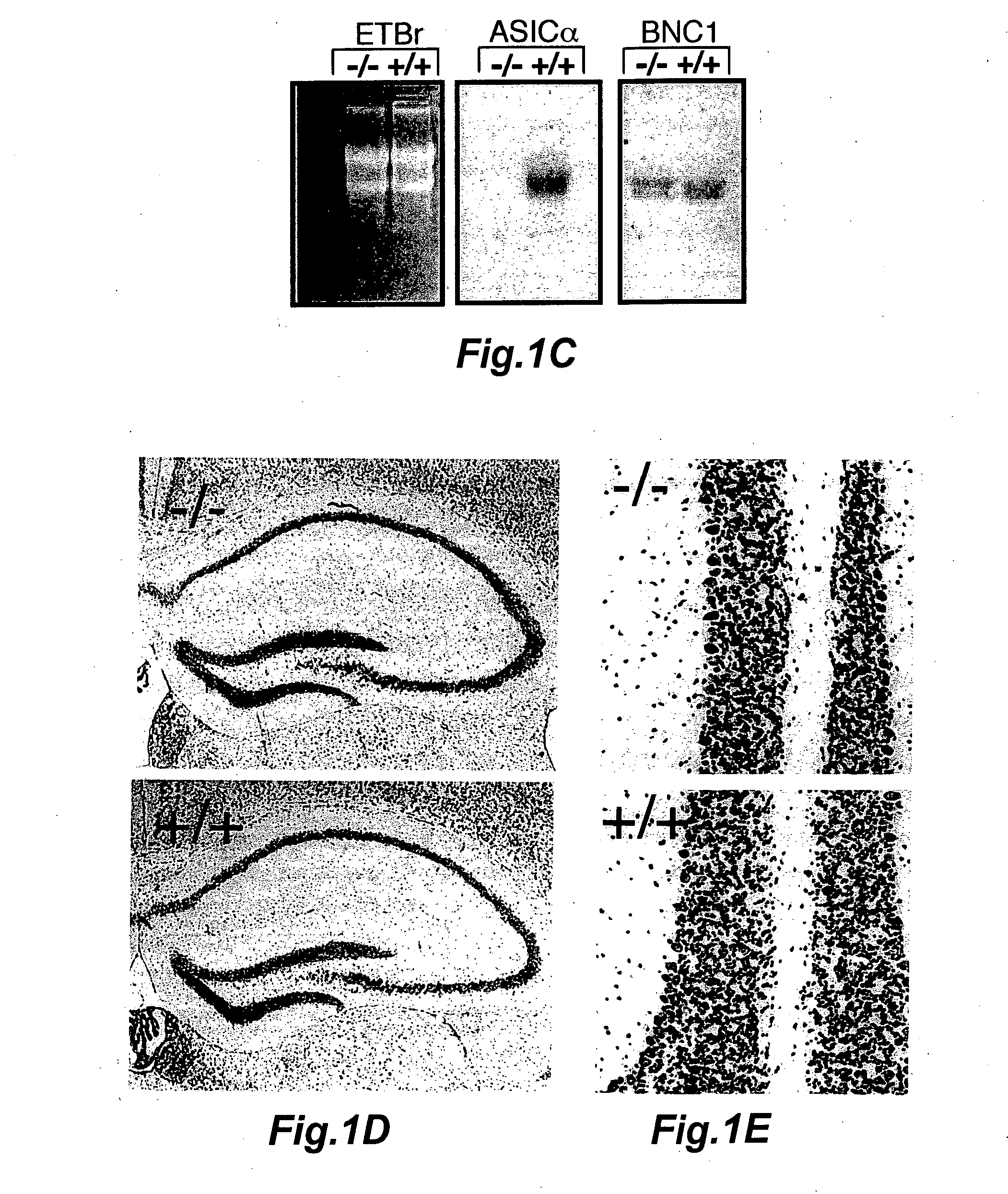 Novel compositions and methods for modulating the acid-sensing ion channel (ASIC)