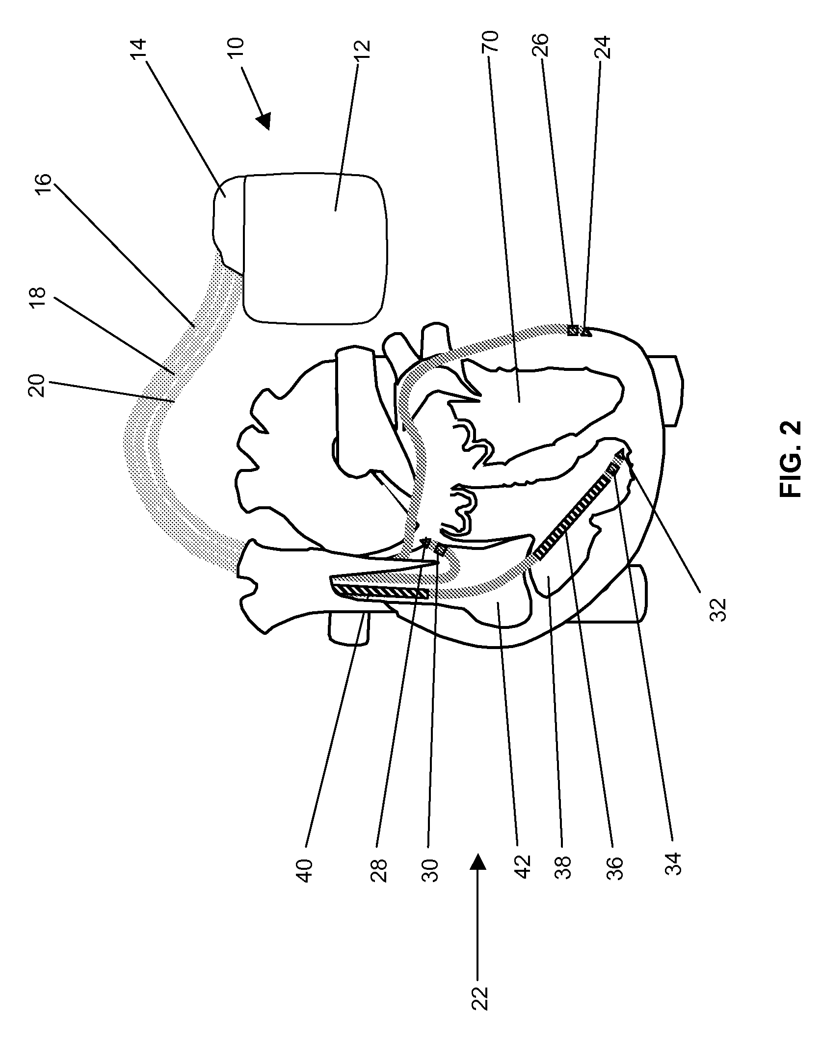 Follow-up support system for implantable medical devices