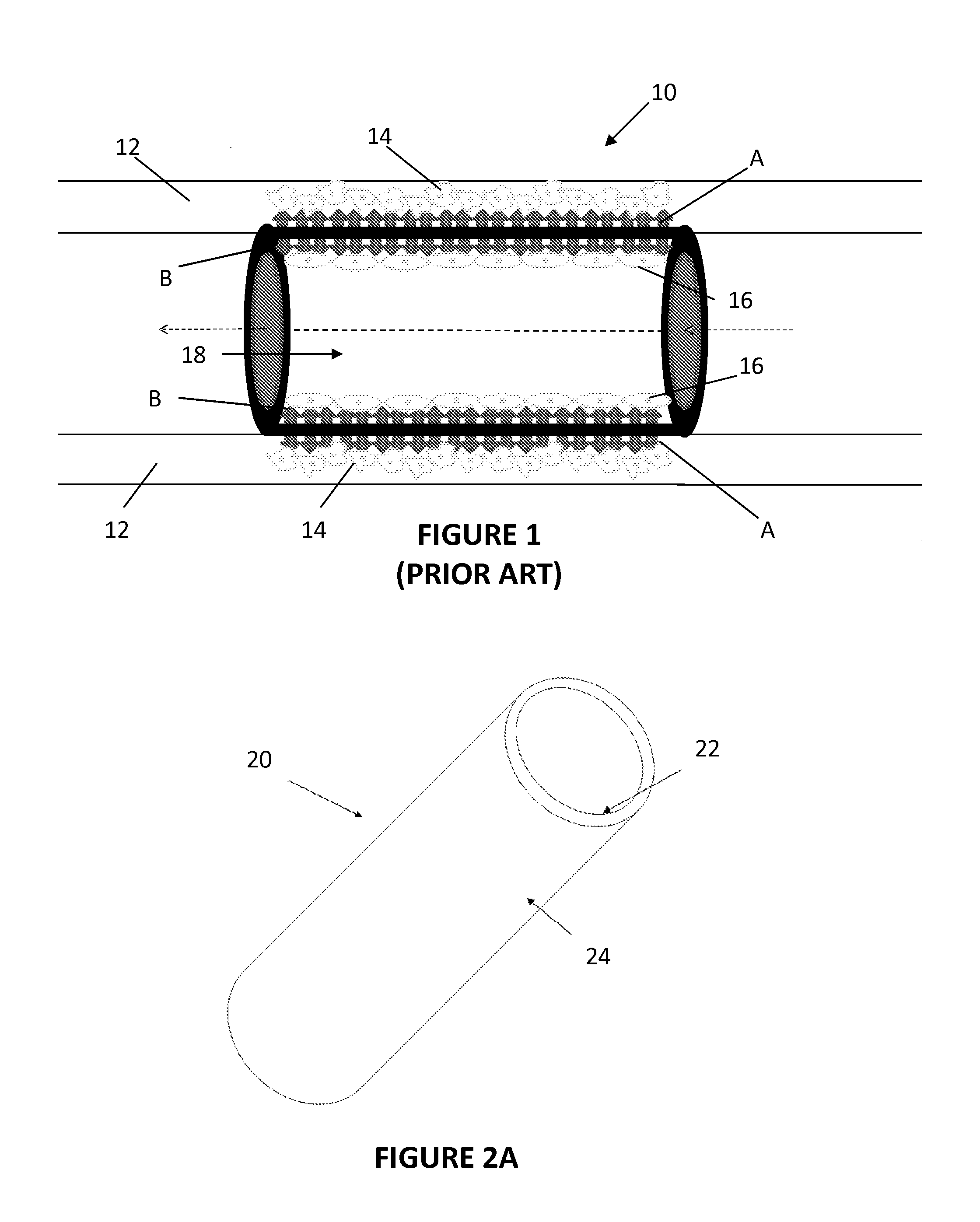 Methods, Systems, and Devices Relating to Directional Eluting Implantable Medical Devices