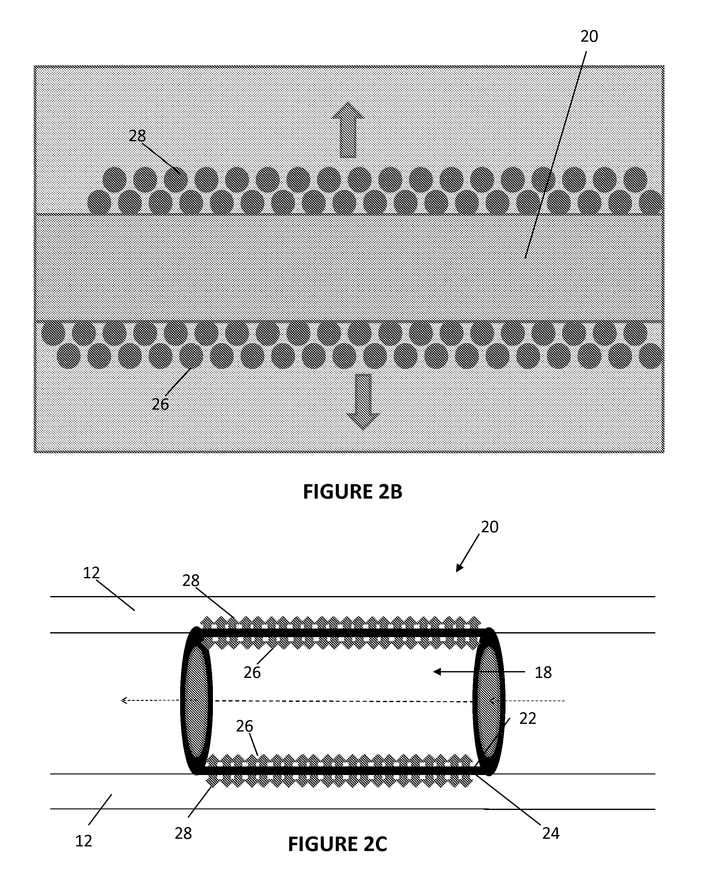 Methods, Systems, and Devices Relating to Directional Eluting Implantable Medical Devices