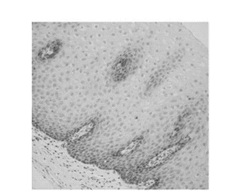 Special short hairpin ribonucleic acid (shRNA) for reducing human IQGAP1 gene expression and application thereof