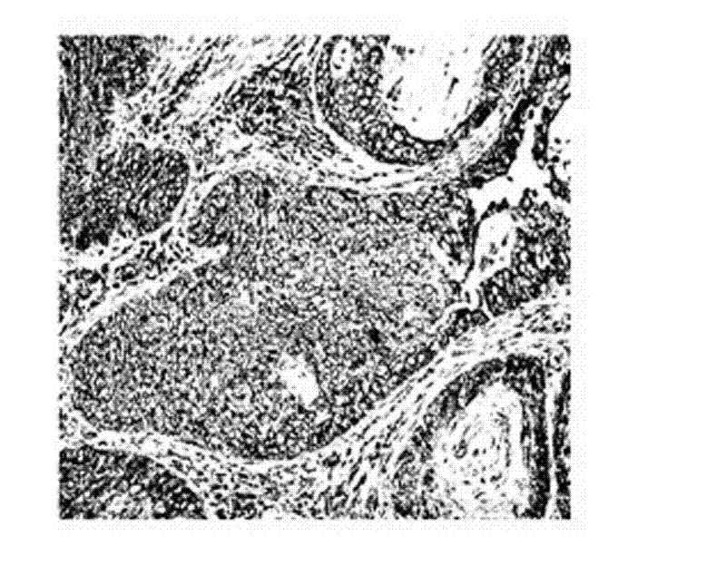 Special short hairpin ribonucleic acid (shRNA) for reducing human IQGAP1 gene expression and application thereof