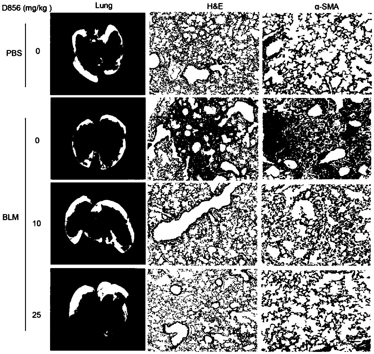 Anti-pulmonary fibrosis application of a DDR2 small molecule inhibitor
