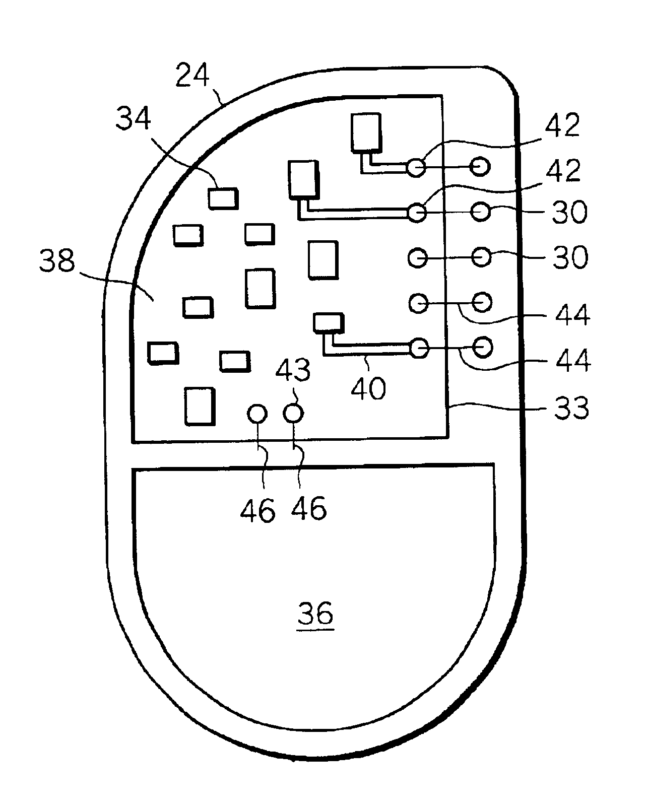 Implantable medical device including a surface-mount terminal array