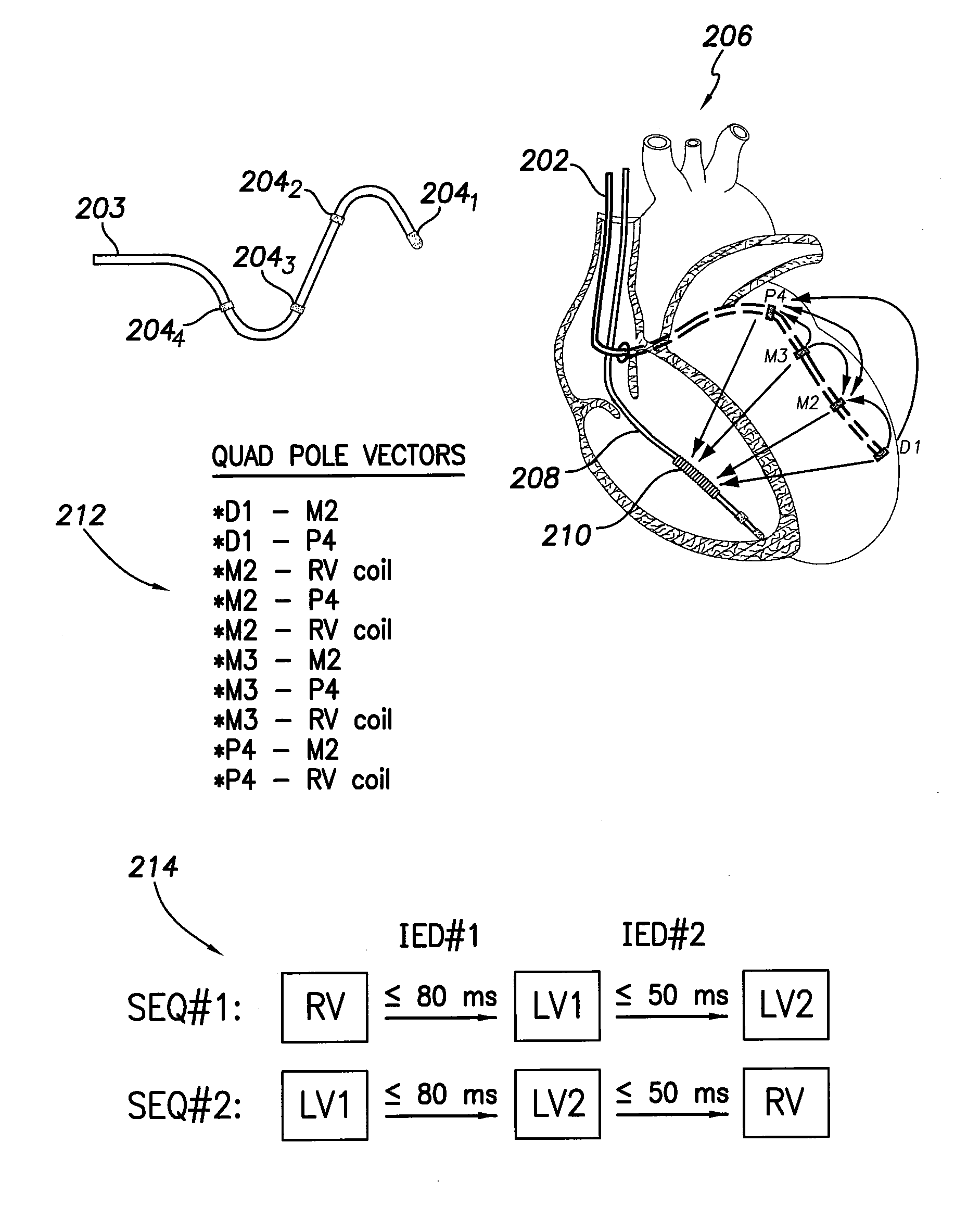 Systems and methods for selectively limiting multi-site ventricular pacing delays during optimization of cardiac resynchronization therapy parameters
