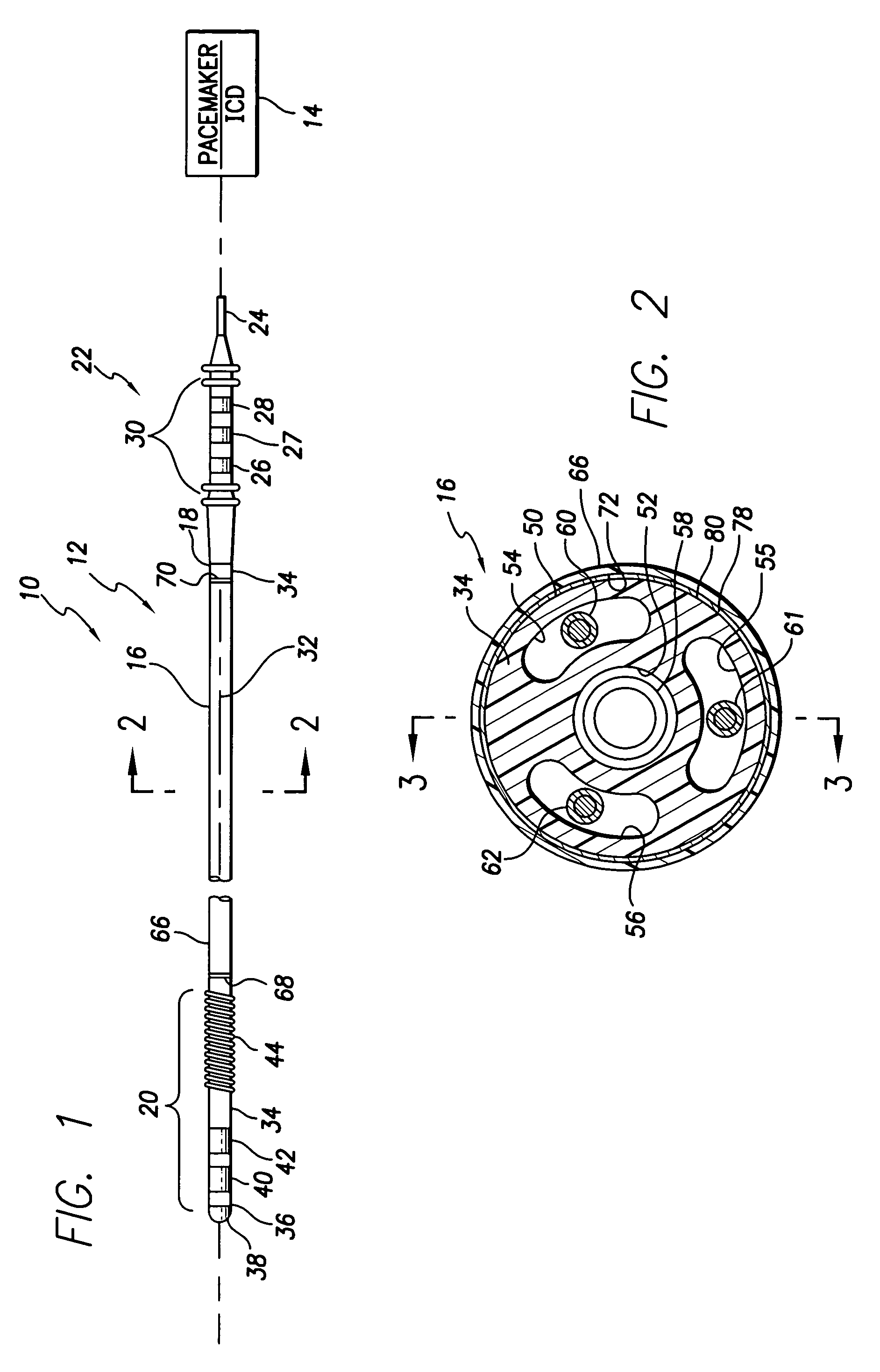 Abrasion-resistant implantable medical lead and a method of fabricating such a lead