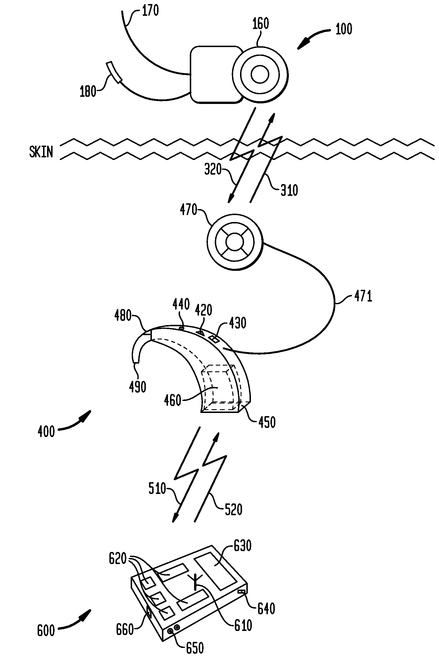 Wireless communication between devices of a hearing prosthesis