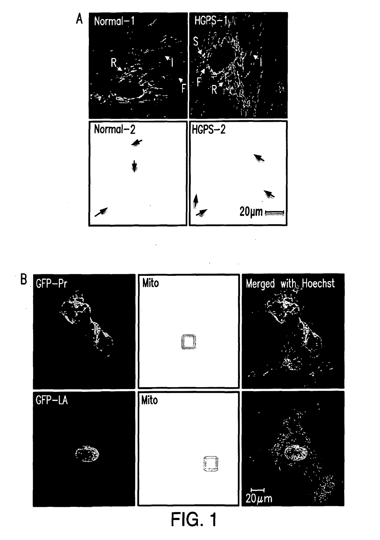 Methods of Treating Age-Related Symptoms in Mammals and Compositions therefor