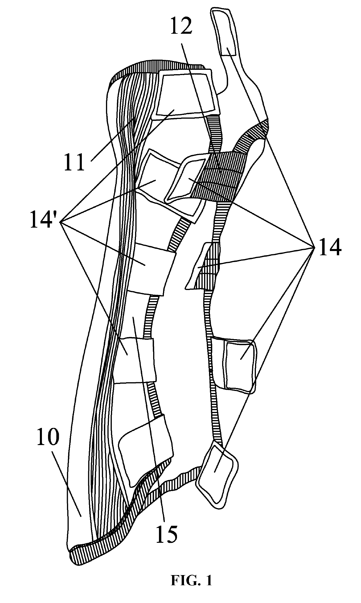 External fixation device for orthopedics of forearm and palm