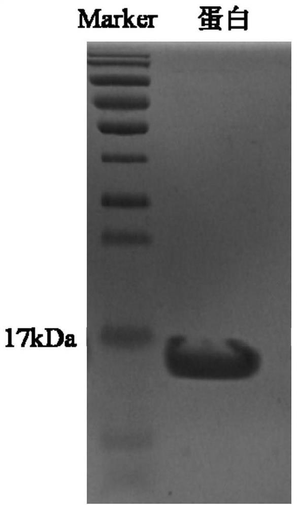 Anti-human IgE protein single-domain antibody and application thereof