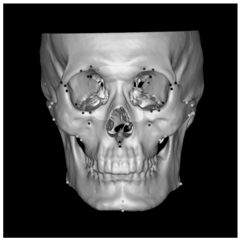 Method for obtaining mid-facial defect target reference data through anatomical feature point matching