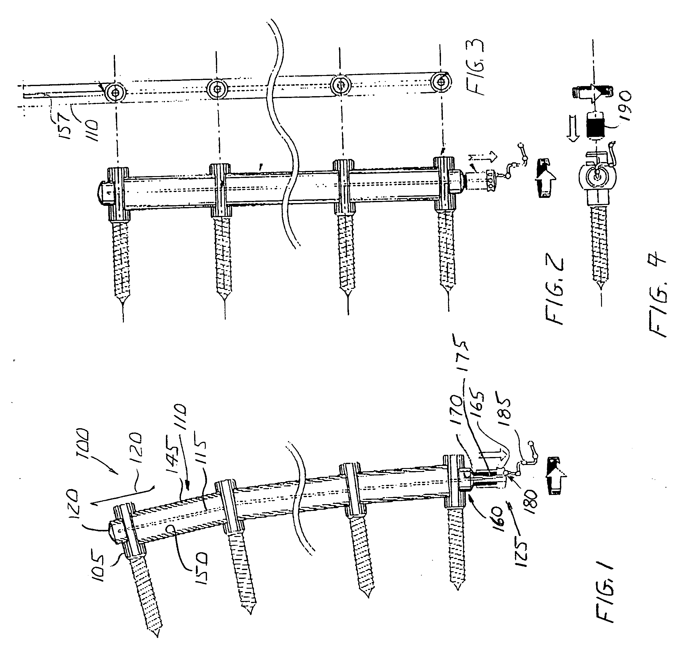 Apparatus for and method of aligning a spine